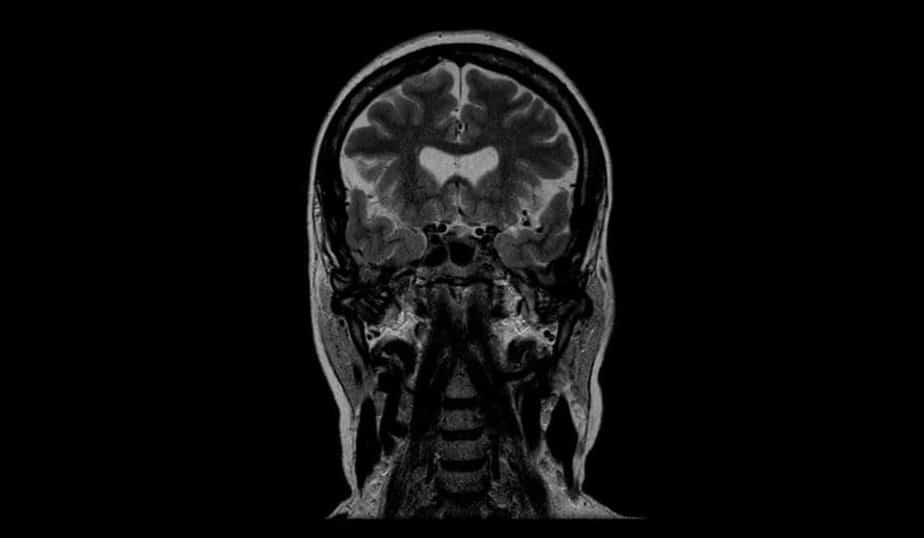 Tomografide iskelet görünür mü? - Kapak Görseli